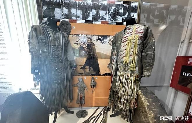 中国故土甩得掉国籍却甩不掉中国胎记！图瓦的4个胎记(图2)